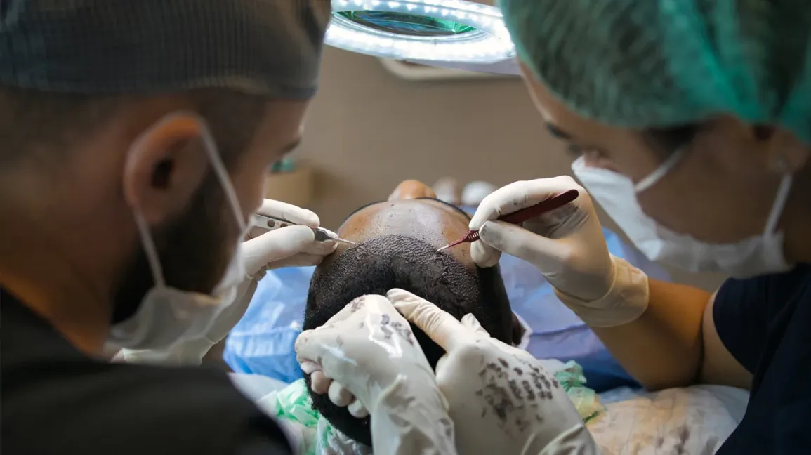 How Many Grafts Do You Need Hair Transplant Cost Based on Graft Count 