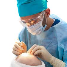 The Best FUE Hair Transplant in Delhi and the Steps to Take for Getting Started