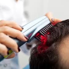 Hair Fall Treatment in Katihar