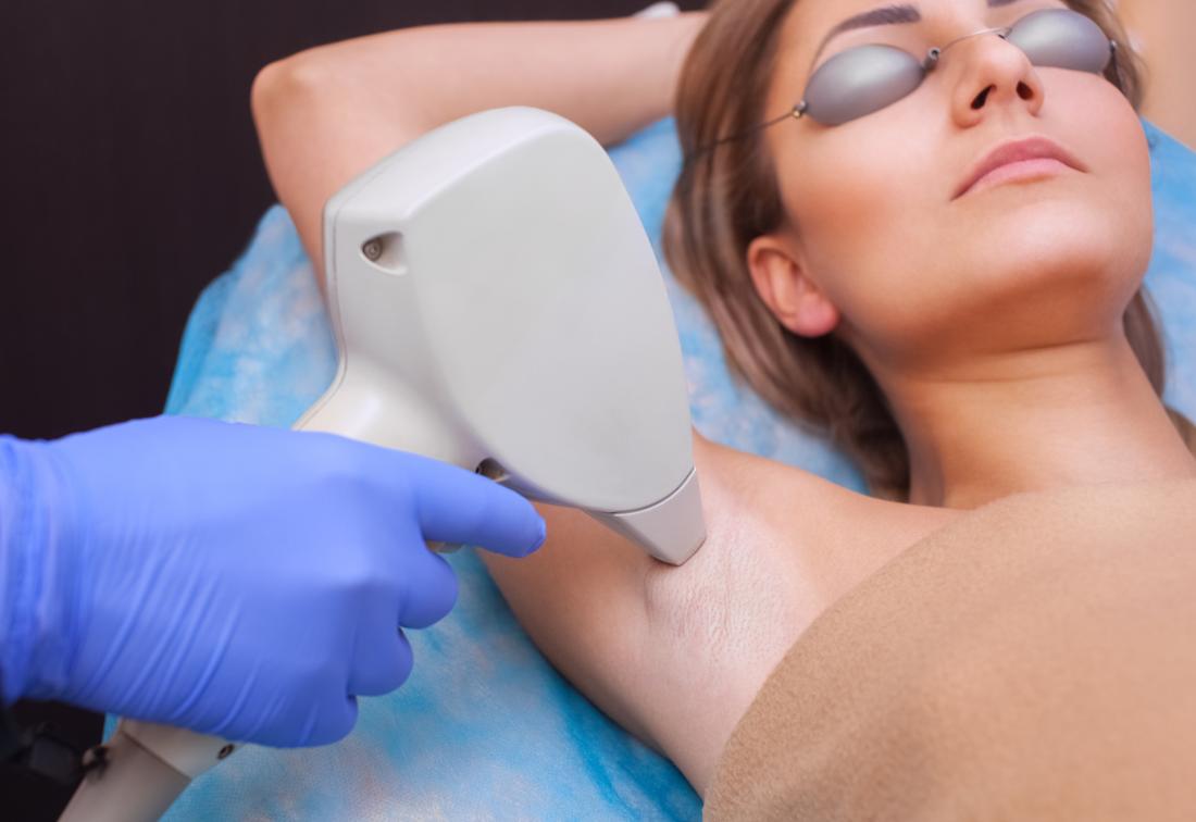 Laser Hair Removal in Koderma