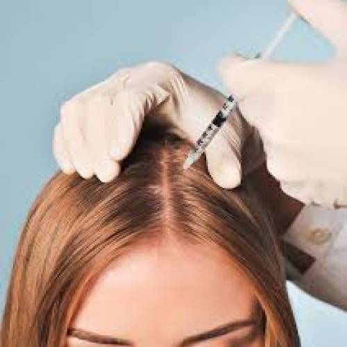 Mesotherapy for Hair Loss in Sikar