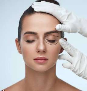 Blepharoplasty in Delhi